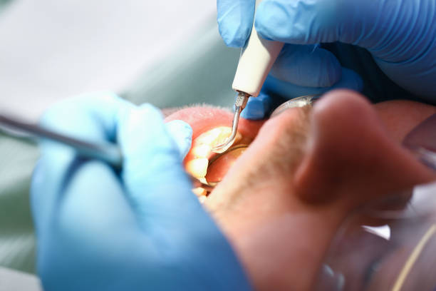 Best Weekend Emergency Dentist in Eden, NC